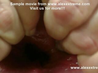 Alexextreme - πρωκτικό γροθιά, ιατρικό εργαλείο εξέτασης κόλπου, πρόπτωση, ακραίο dildo