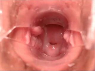 Ohmibod मलाईदार कम स्पकुलम डीप इनसाइड cervix: एचडी सेक्स चलचित्र ba